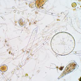 Phytoplankton under the miscoscope
