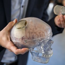 Zwei Hände halten ein Silikonmodell des menschlichen Gehirns und zeigen zwei elektronische Implantate. 
