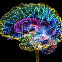 Farbige 3D-Magnetresonanztomographie (MRI) eines gesunden menschlichen Gehirns.