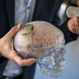 Two hands hold a silicone model of the human brain and show two electronic implants. 